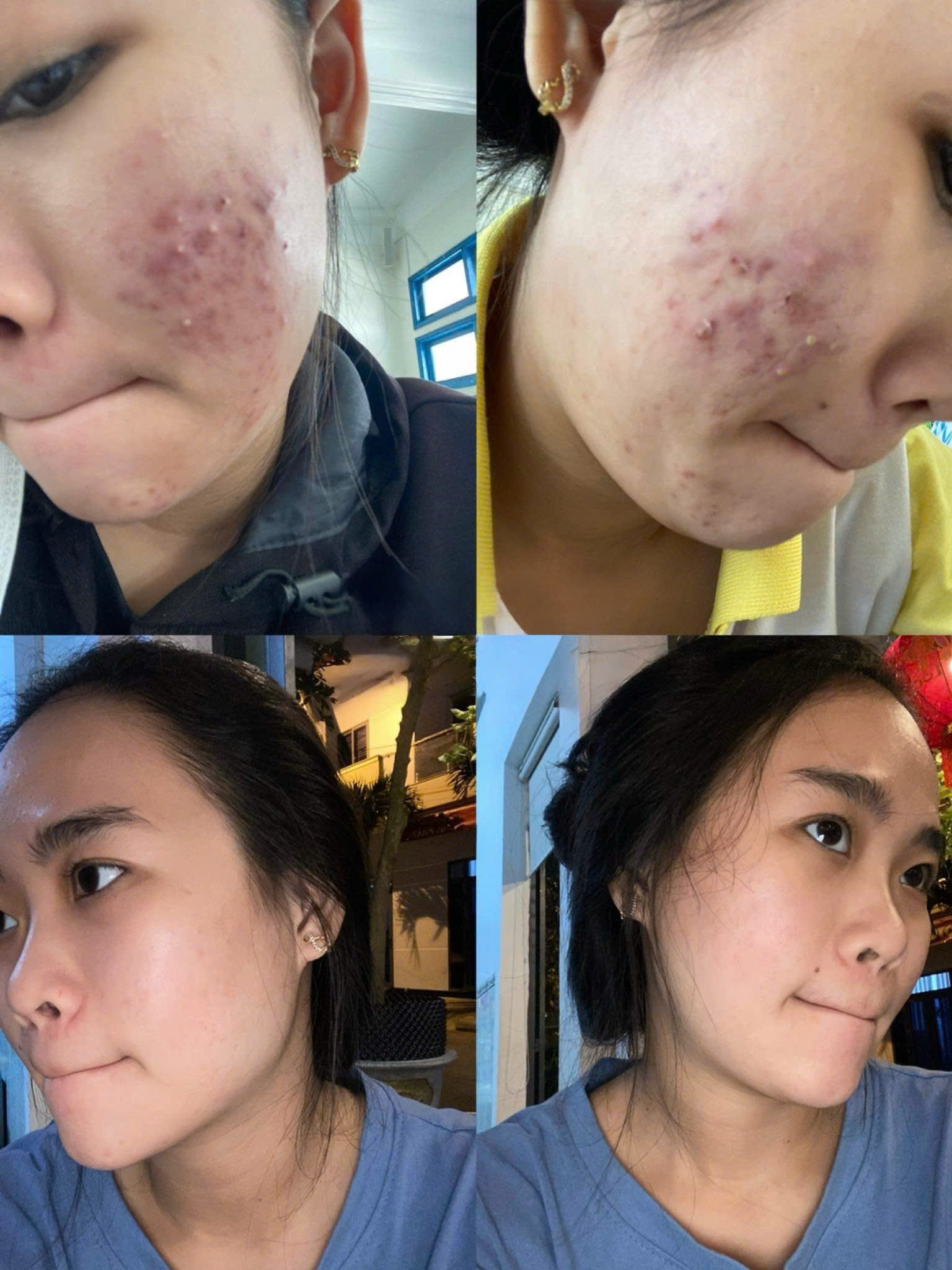 Khách bị kích ứng da, sử dụng sau 2 tháng